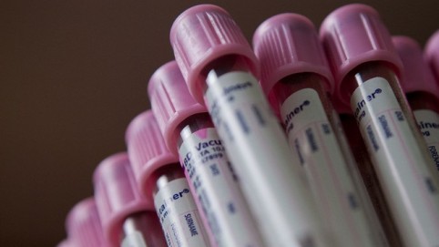 Purple-capped specimen vials 